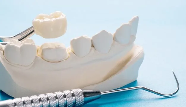Coroane dentare ceramice pe zirconiu la clinica Irident