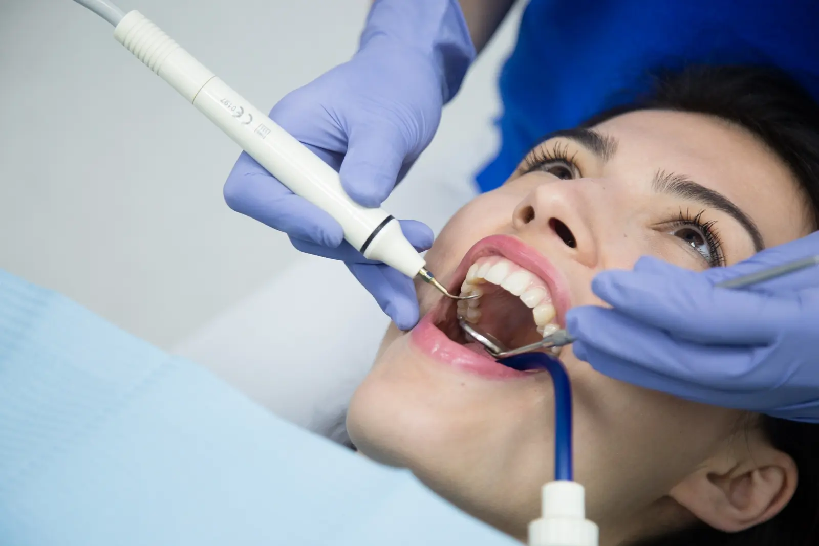 Profilaxie dentară la clinica Irident